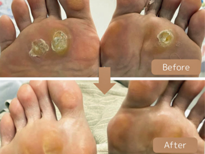 巻き爪ケア&フットケア専門サロンPedi Labo ペディラボのお薦め